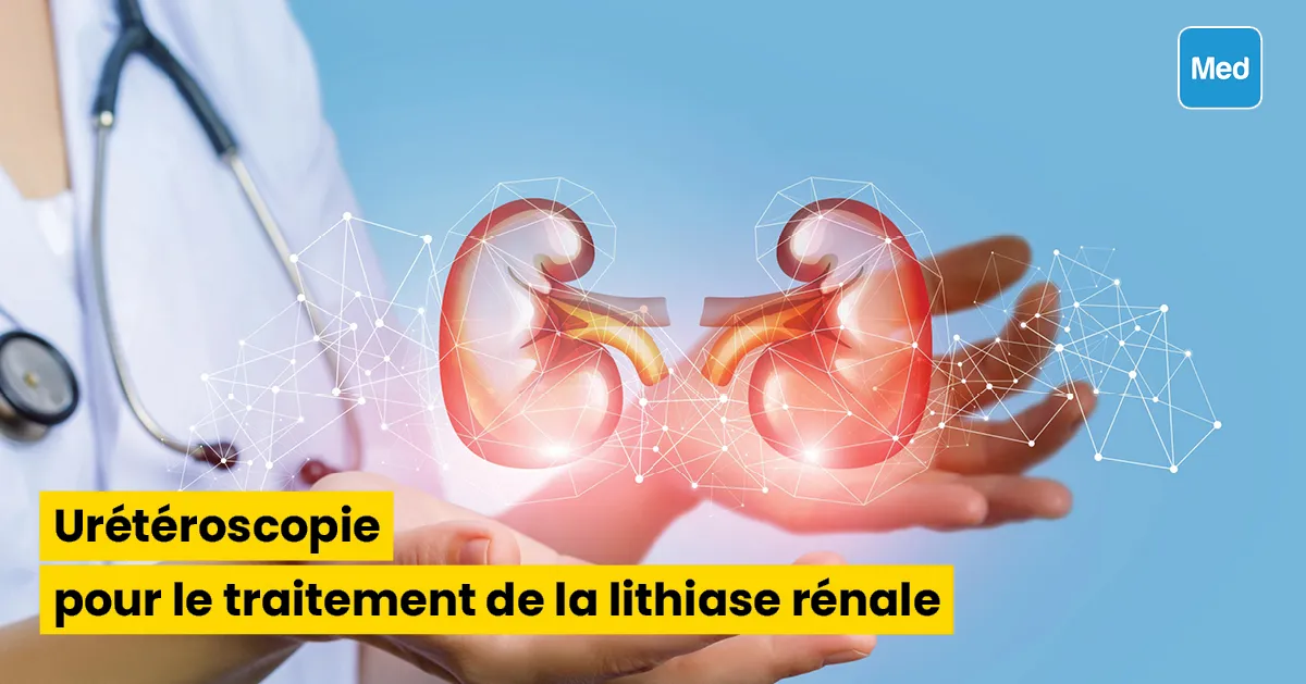 Urétéroscopie pour le traitement de la lithiase rénale